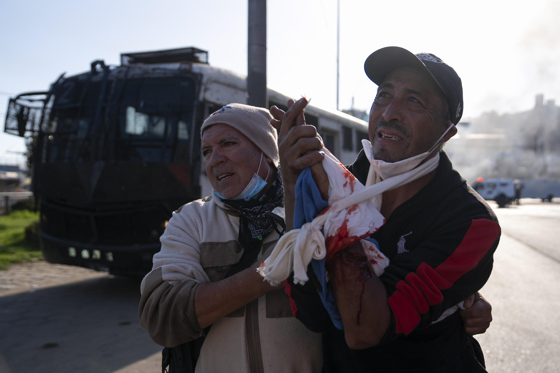 Un manifestante es herido durante una protesta de pescadores artesanales este miércoles, en Valparaiso (Chile). EFE/ ADRIANA THOMASA