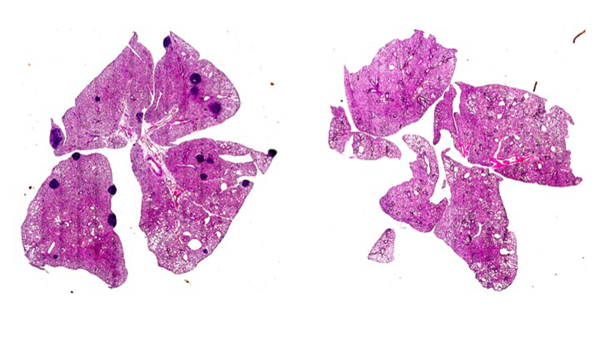 En la imagen de la izquierda: tumores de mama de ratón que  desarrollaron cáncer metastásico en los pulmones (zonas oscuras de la imagen), y en la de la derecha, la misma imagen limpia de metástasis en ratones que recibieron tratamiento con aspirina. Fotografía facilitada por Jie Yang. EFE
