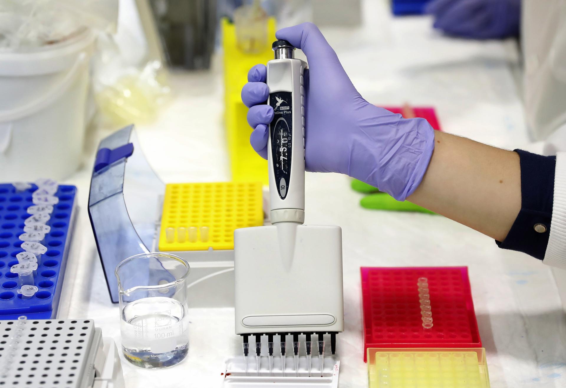 Imagen de archivo de un laboratorio donde trabajan en un método de cribado no invasivo que mejora la detección precoz del cáncer de colon. EFE/Andreu Dalmau