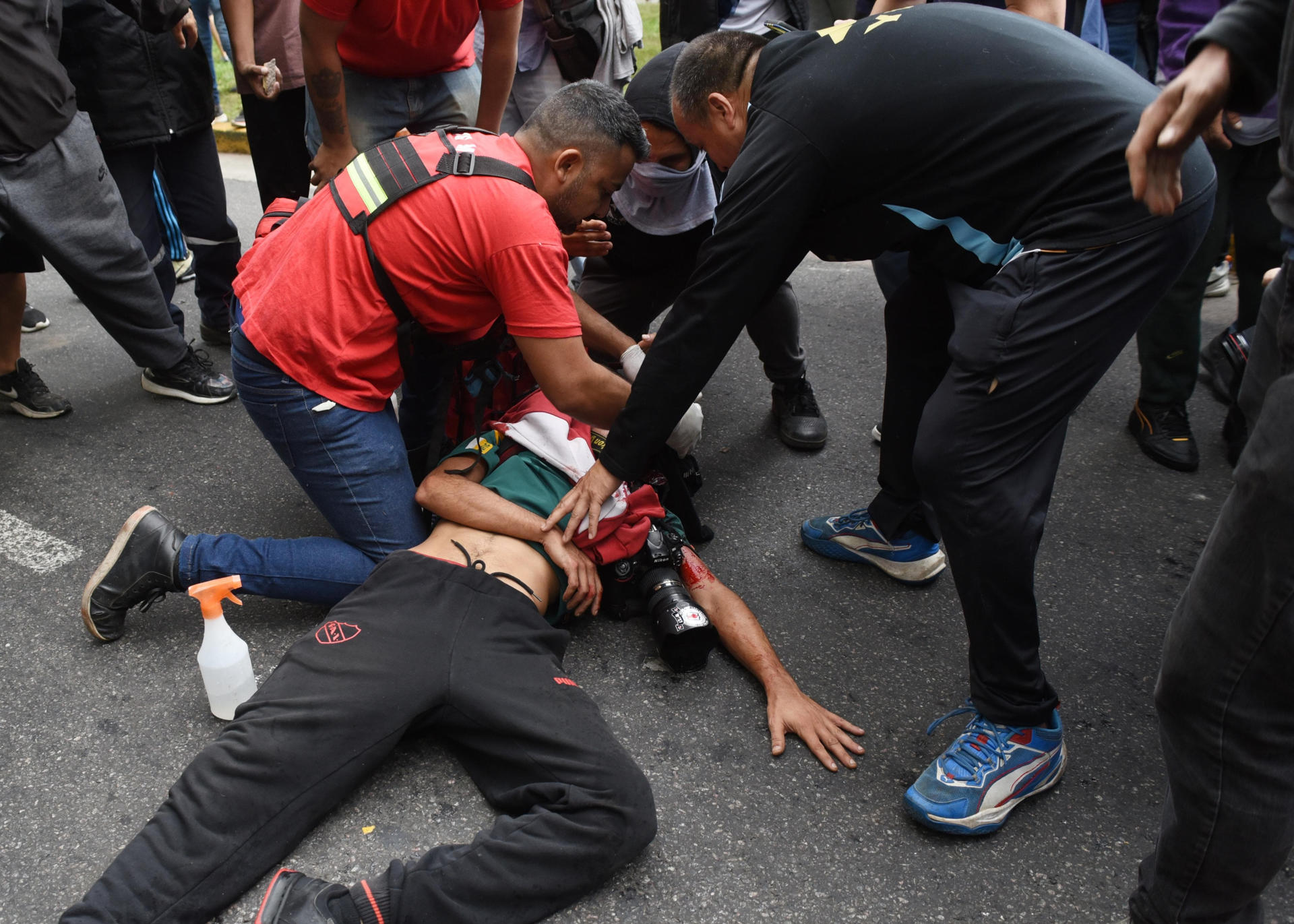 El fotógrafo Pablo Grillo es herido de gravedad durante una manifestación este 12 de marzo de 2025, en Buenos Aires (Argentina). EFE/ Str