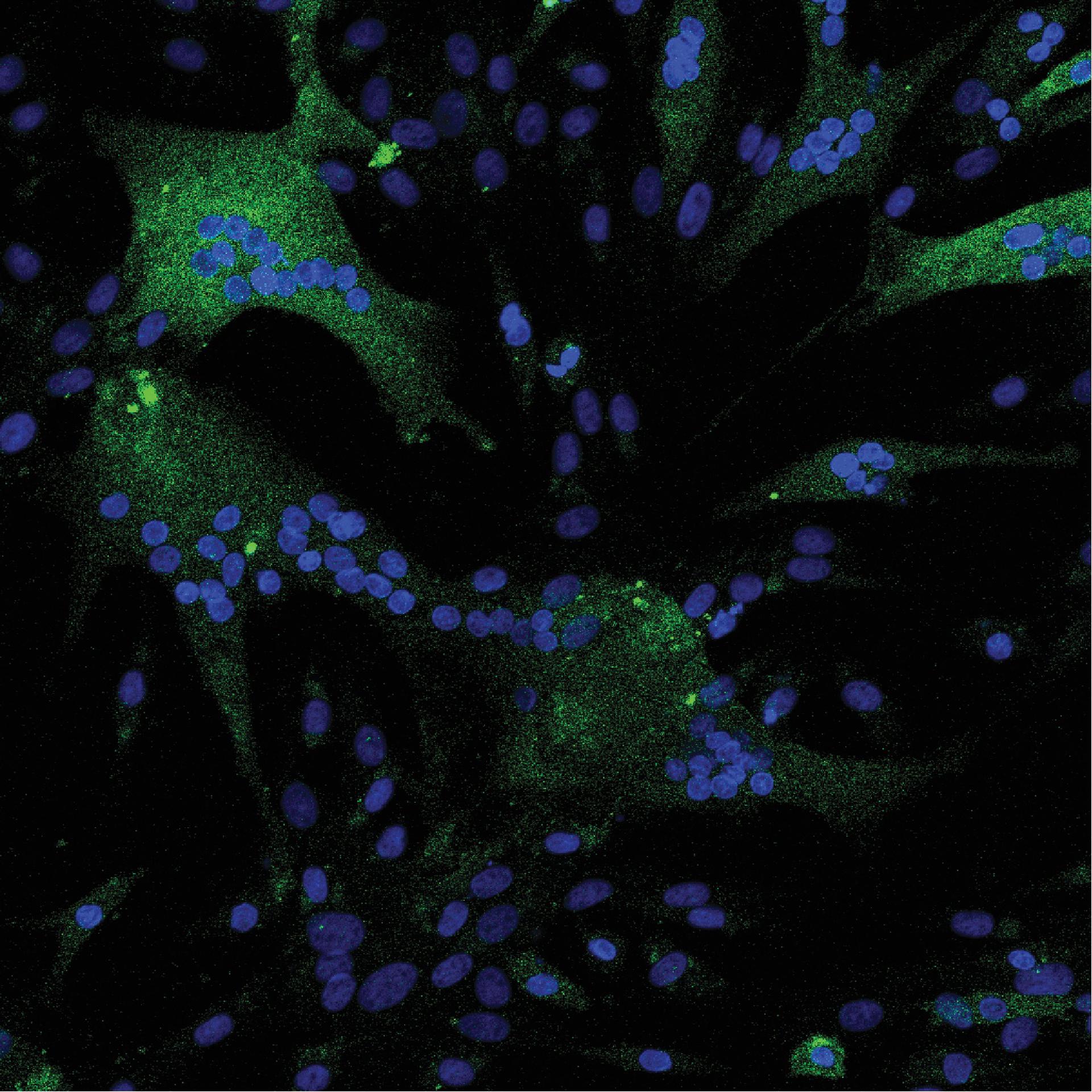 El estudio molecular de la fibra muscular de un caballo de carreras pura sangre ha revelado una adaptación genética para hacerle más atlético. EFE/Crédito Lingli Zhou y Gianni Castiglione/Revista Ciencia