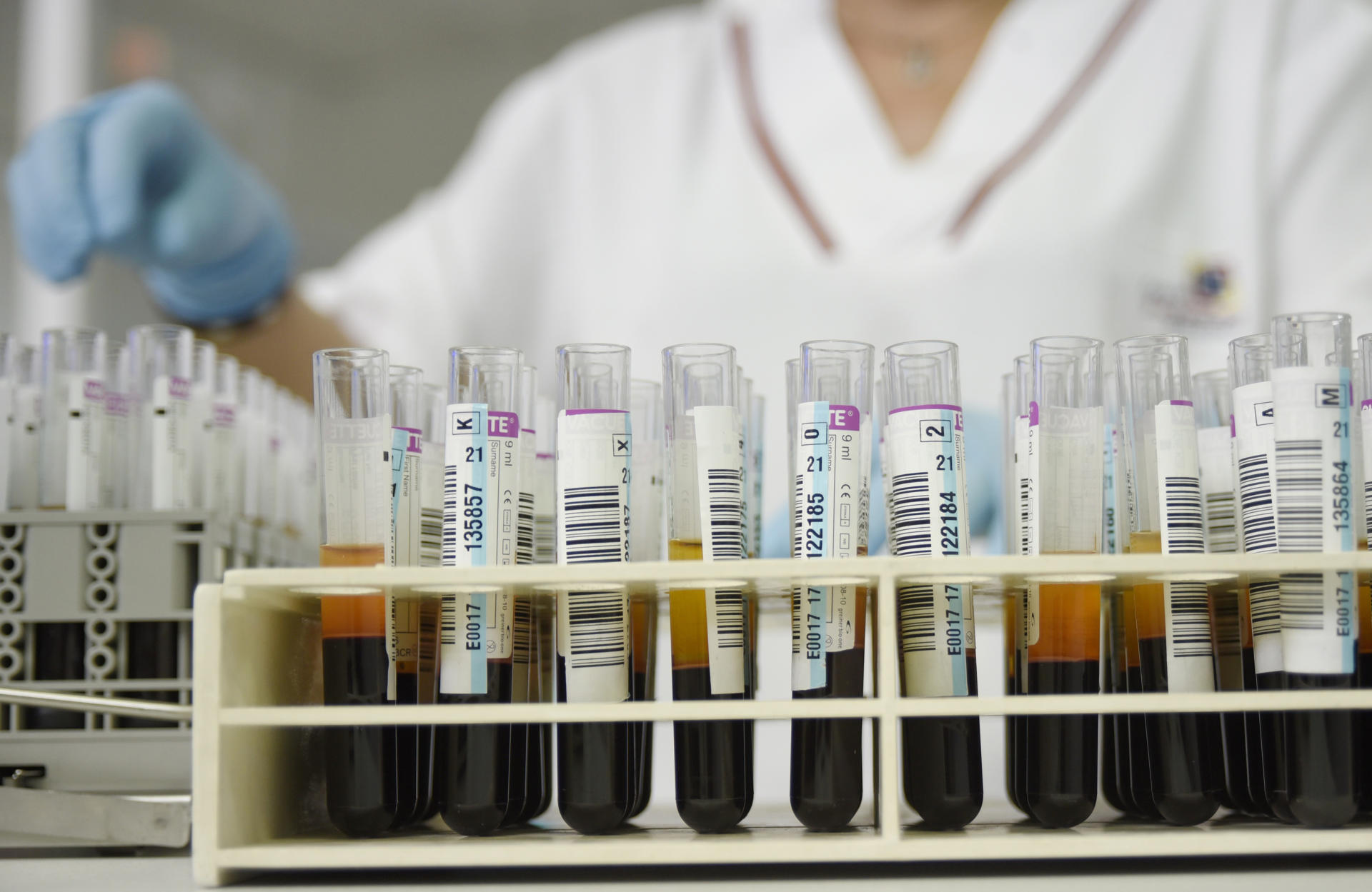 Fotografía de archivo de tubos con sangre en un laboratorio. EFE/Atienza.