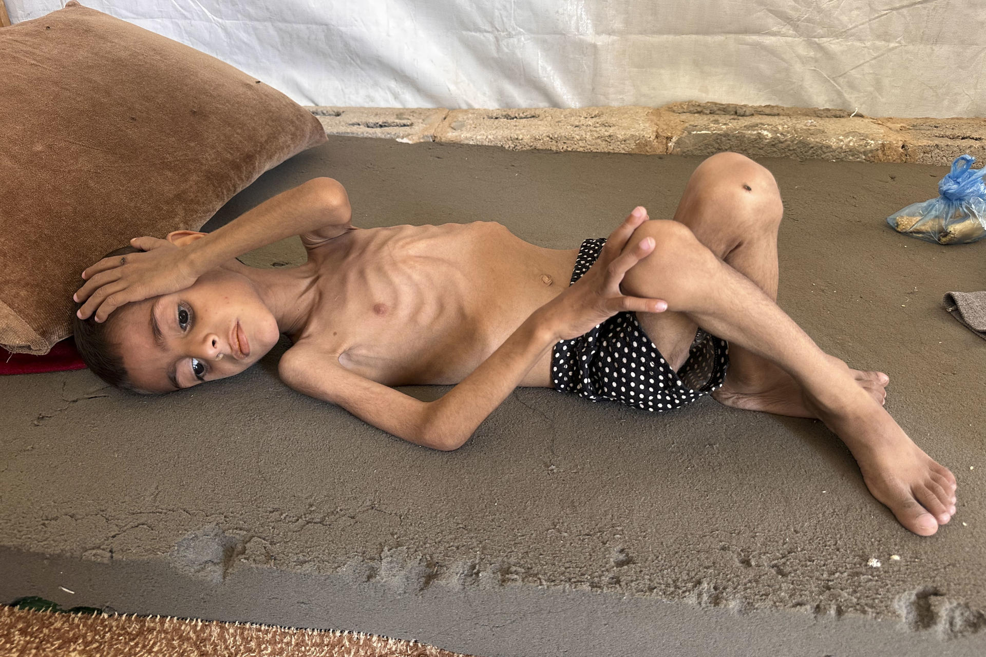 El niño gazatí Osama al Raqab, de 5 años, quiere jugar al fútbol o montar en bicicleta, pero la falta de energía no se lo permite. Como él, decenas de miles de niños en Gaza padecen malnutrición, debido a que Israel no permite la entrada de suministros -agua, comida, ayuda humanitaria o combustible- desde hace 50 días. EFE/ Ahmad Awad