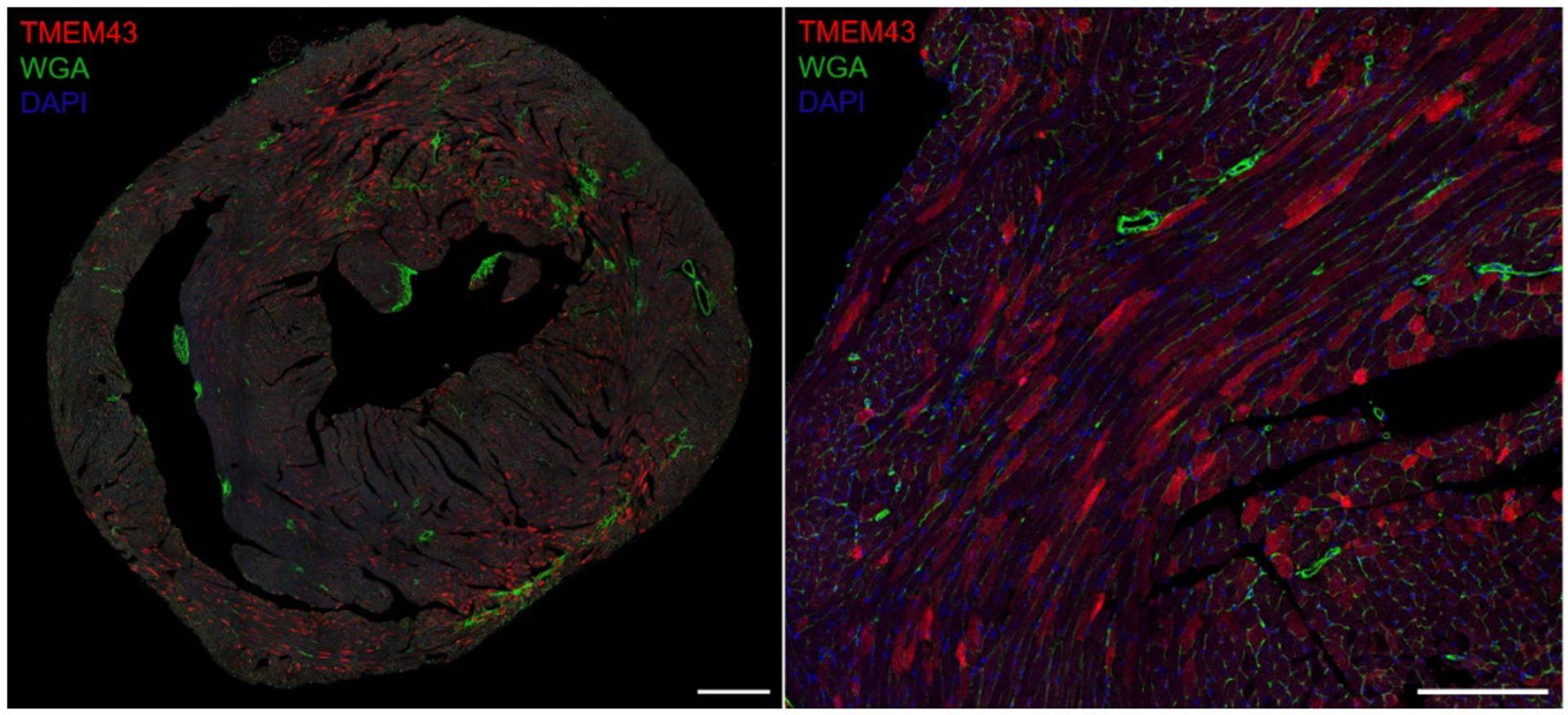 Un equipo del Centro Nacional de Investigaciones Cardiovasculares (CNIC) ha conseguido desarrollar una innovadora terapia génica para tratar una enfermedad del corazón rara que es devastadora en hombres jóvenes. La imagen muestra el vector de terapia génica (rojo) en el corazón de un ratón tratado, demostrando la introducción exitosa de la una proteína en las células cardíacas. Imagen cedida por el CNIC.