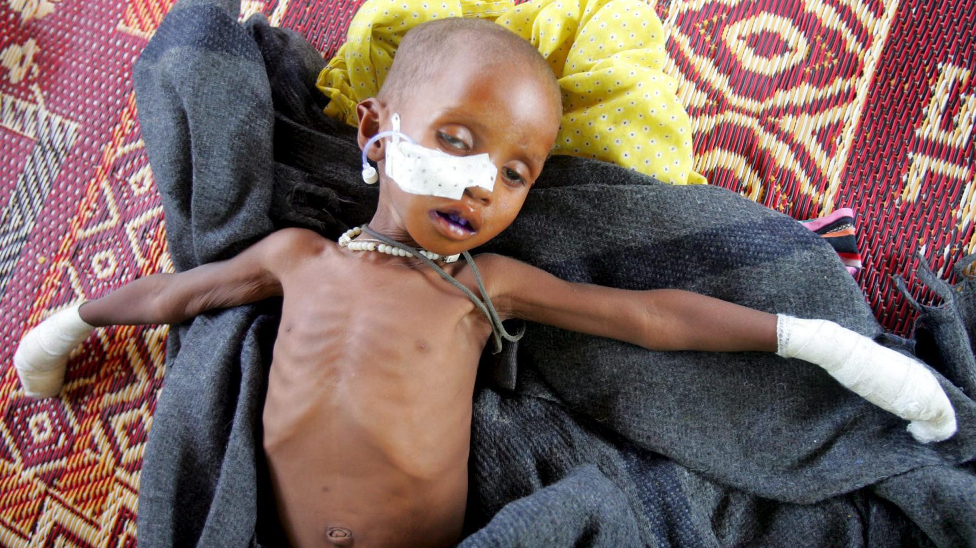 Imagen de archivo de un bebe en un campamento de refugiados en Darfur, en el oeste de Sudán. EFE/Khaled el Fiqi