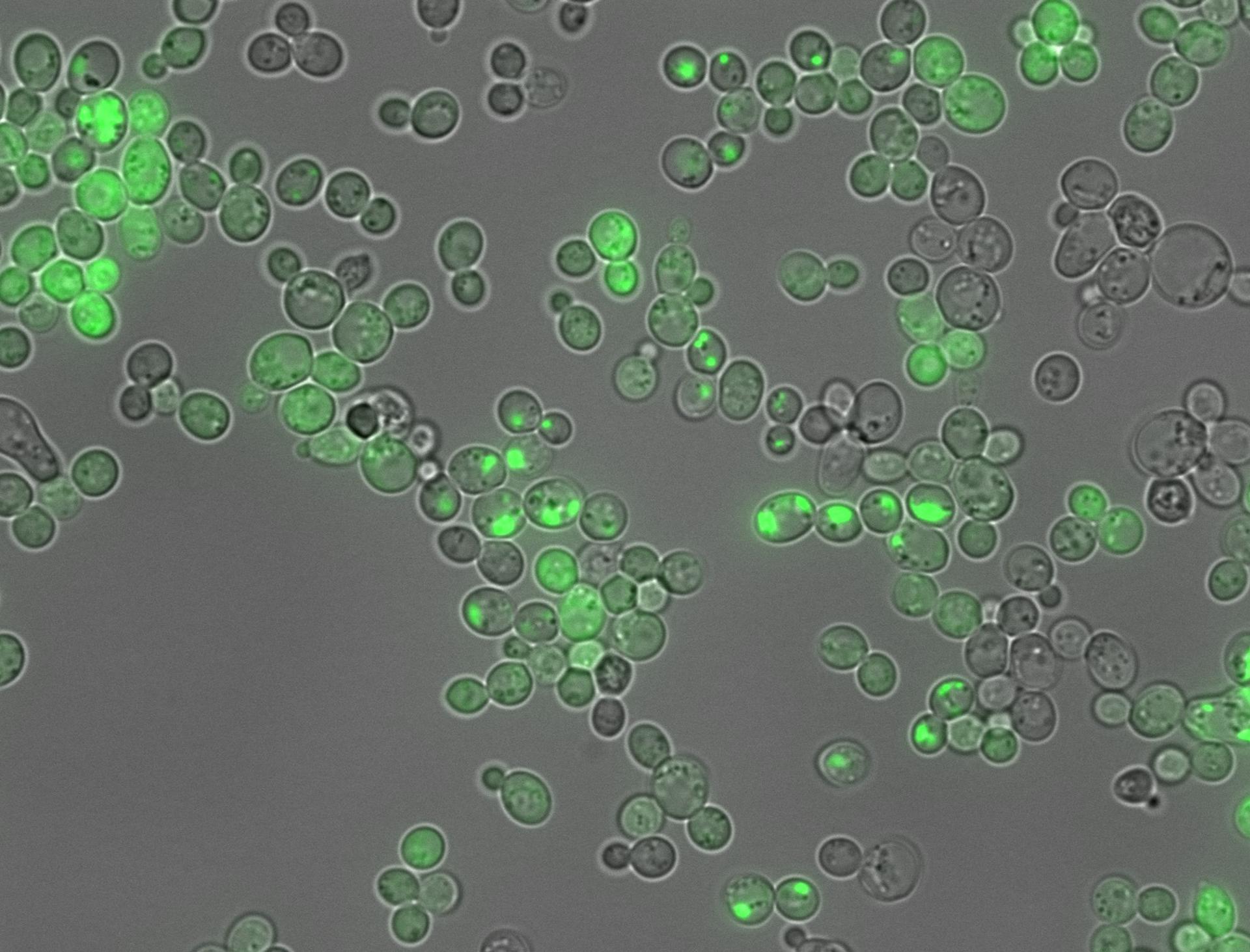 Agregación amiloide dentro de células marcadas mediante técnicas de fluorescencia. Crédito: Benedetta Bolognesi/IBEC.