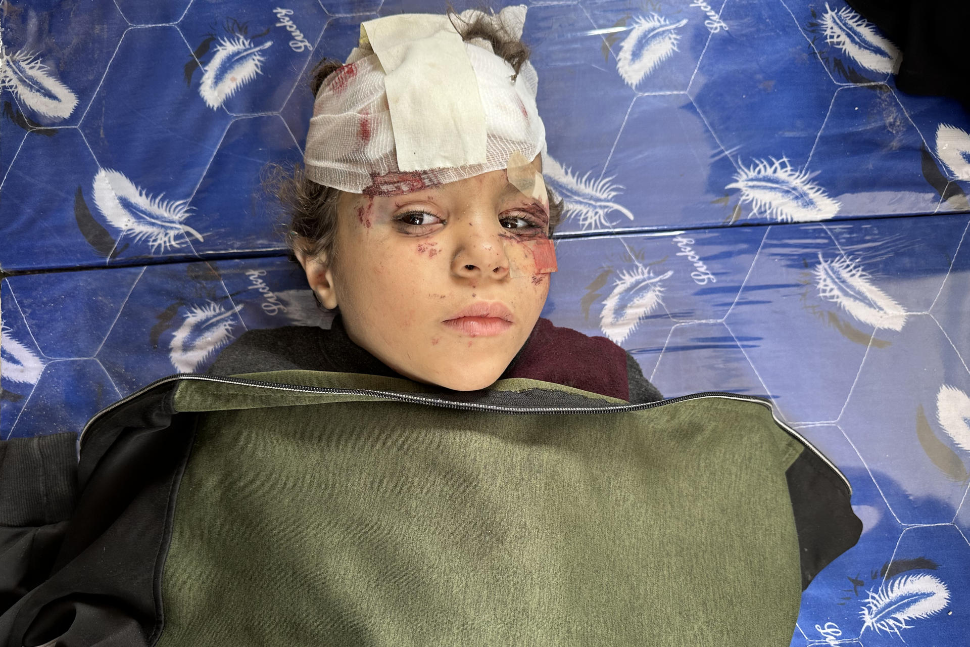 Imagen de un niño herido debido a un ataque de un avión israelí contra un bloque de viviendas en el barrio de Shujaiya, al este del norte de la ciudad de Gaza, el 9 de abril de 2025. Al menos 23 personas murieron en el ataque, incluidas ocho mujeres y ocho niños, confirmaron a la agencia de noticias EFE fuentes médicas del Hospital Al Ahli. EFE/ Ahmad Awad