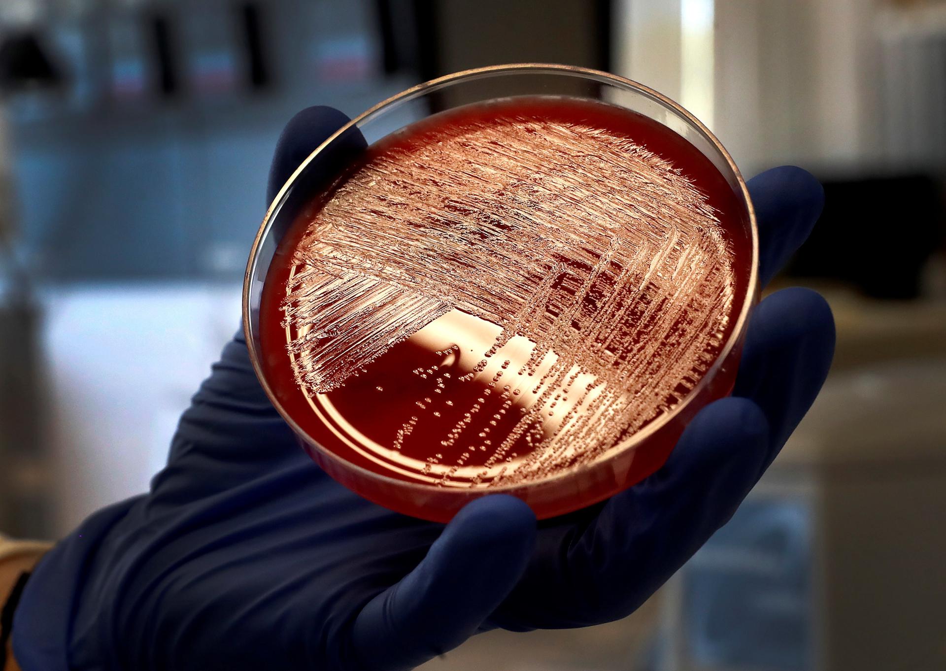 Vista de un cultivo de la bacteria de la listeriosis en una placa de Petri. EFE/Chema Moya