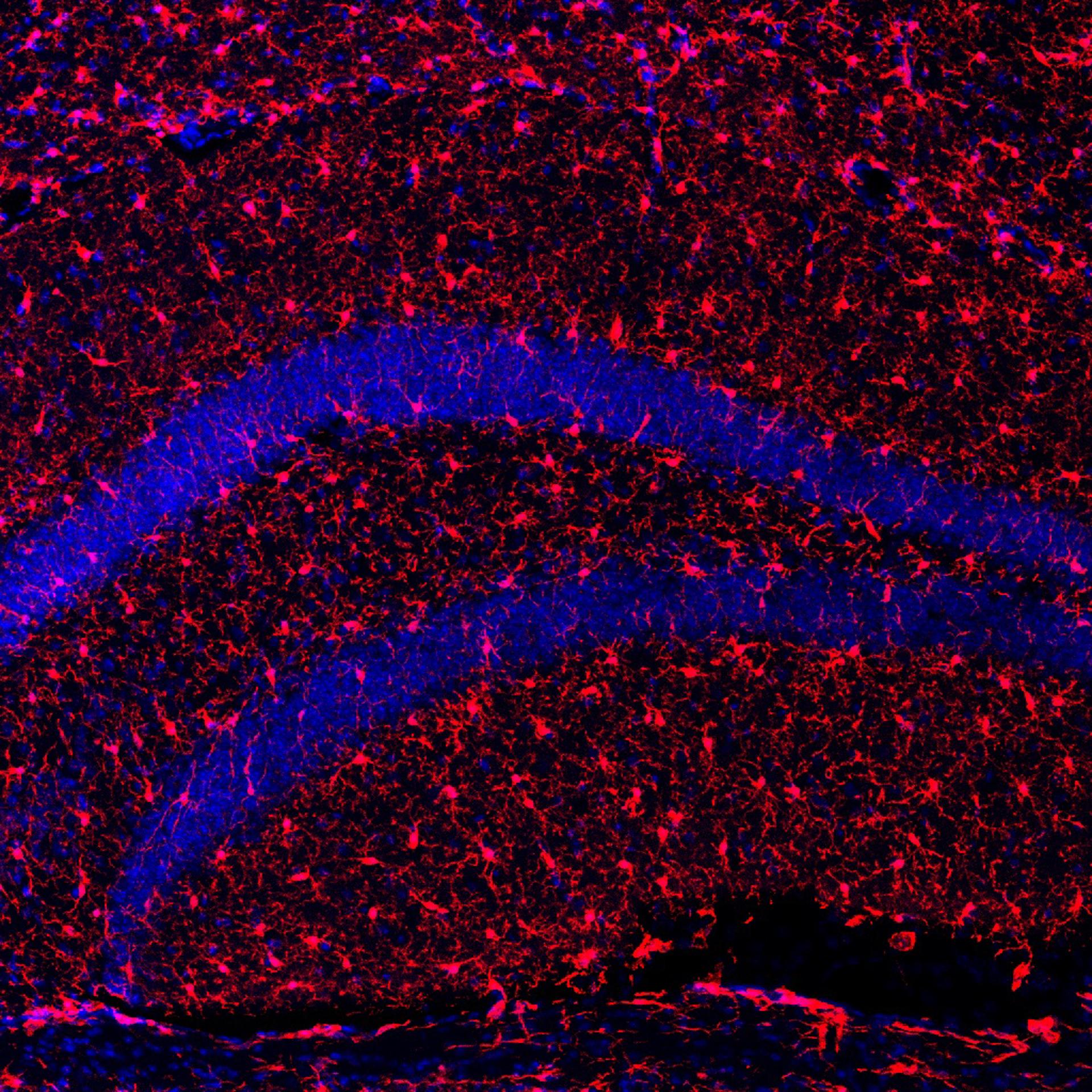 Imagen con microscopía de células microgliales (parte del sistema inmune del cerebro, en rojo) del hipocampo de los ratones tratados con s-KL. El tratamiento aumentó el número de estas células, mejorando su actividad fagocítica, que habitualmente se ve deteriorada durante el envejecimiento cerebral.  EFE/Crédito:UAB