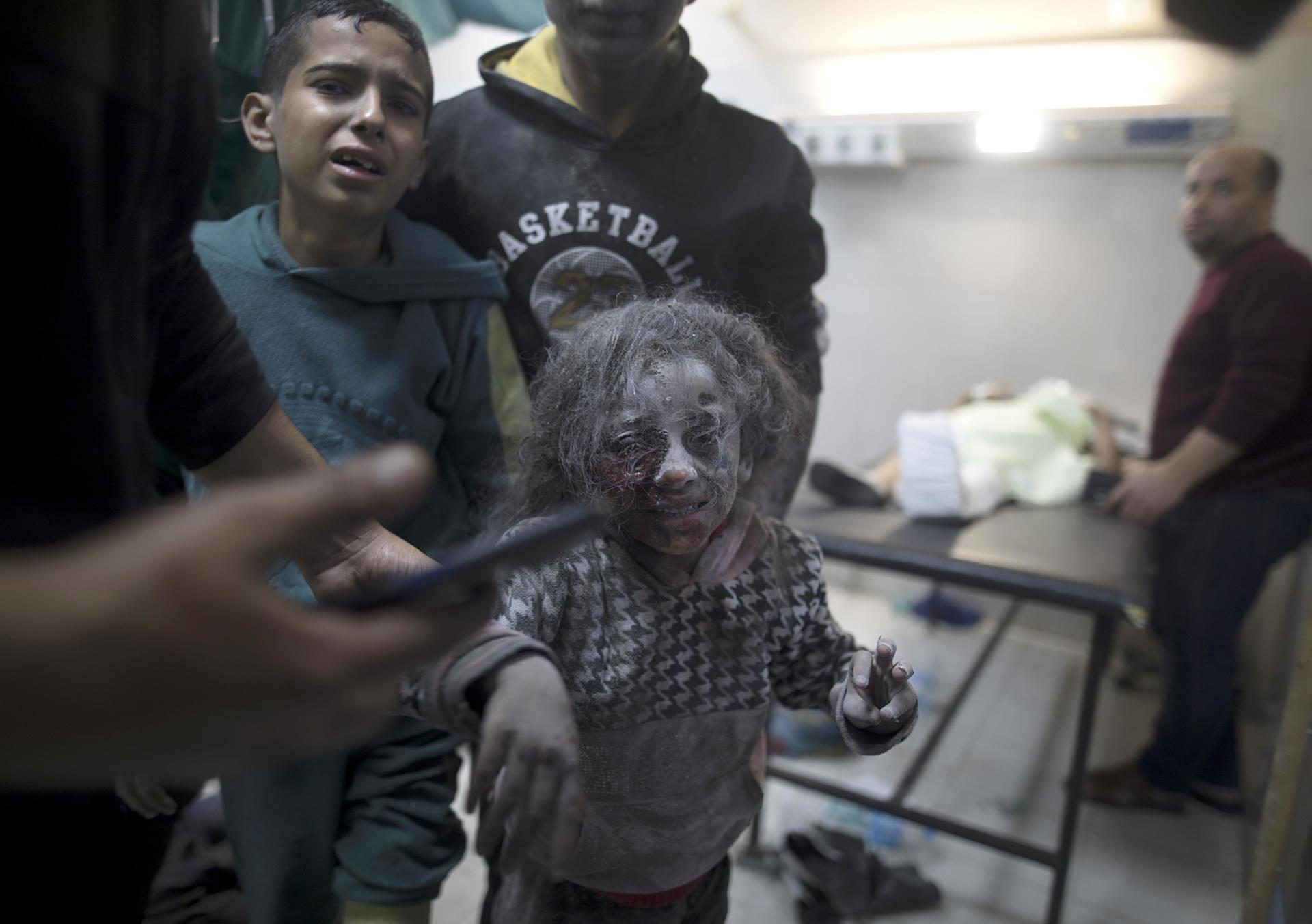 Una niña herida en los ataques aéreos israelíes sobre el sur de Gaza llega al Hospital Nasser en Khan Yunis, sur de la Franja de Gaza, el 07 de diciembre de 2023. EFE/EPA/HAITHAM IMAD