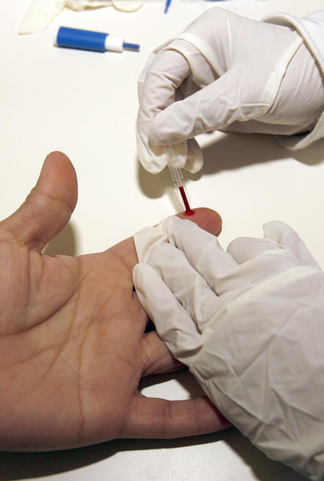 En la imagen de archivo, toma de una muestra de sangre para la realización de un análisis de colesterol. EFE/Gustavo Cuevas
