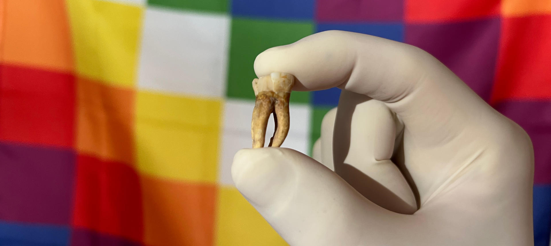 A partir de muestras como este diente, hallado en un yacimiento de Argentina, los científicos pueden analizar el ADN antiguo y reconstruir genomas humanos y patógenos del pasado. Crédito: © Nicolas Rascovan, Instituto Pasteur