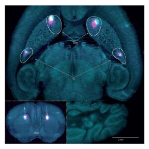La imagen muestra las dos regiones del cerebro que se inactivaron durante el estudio: el estriado dorsomedial (DMS) y la cola del estriado (TS). Crédito: Hernando Martinez Vergara.