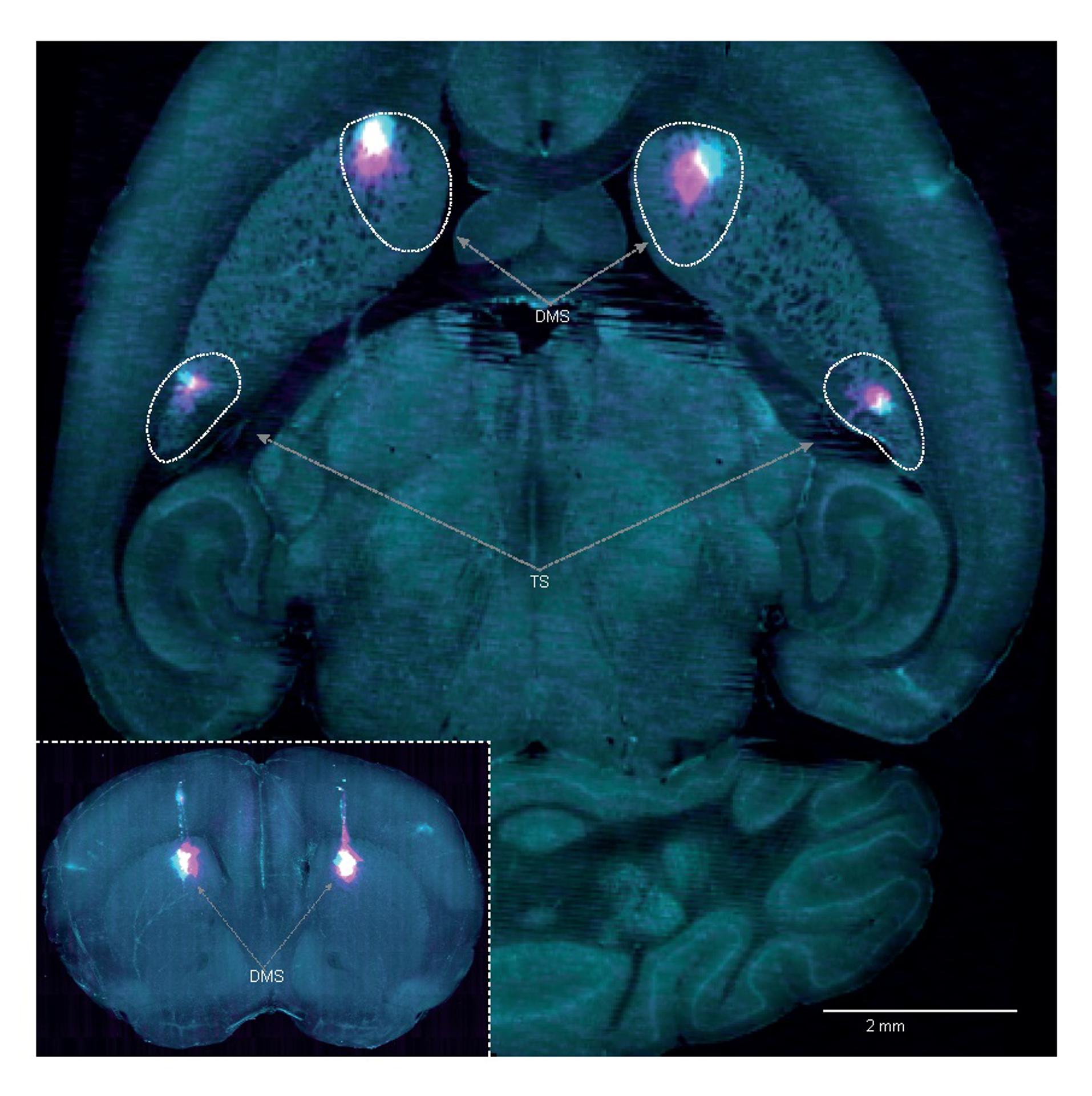 La imagen muestra las dos regiones del cerebro que se inactivaron durante el estudio: el estriado dorsomedial (DMS) y la cola del estriado (TS). Crédito: Hernando Martinez Vergara.