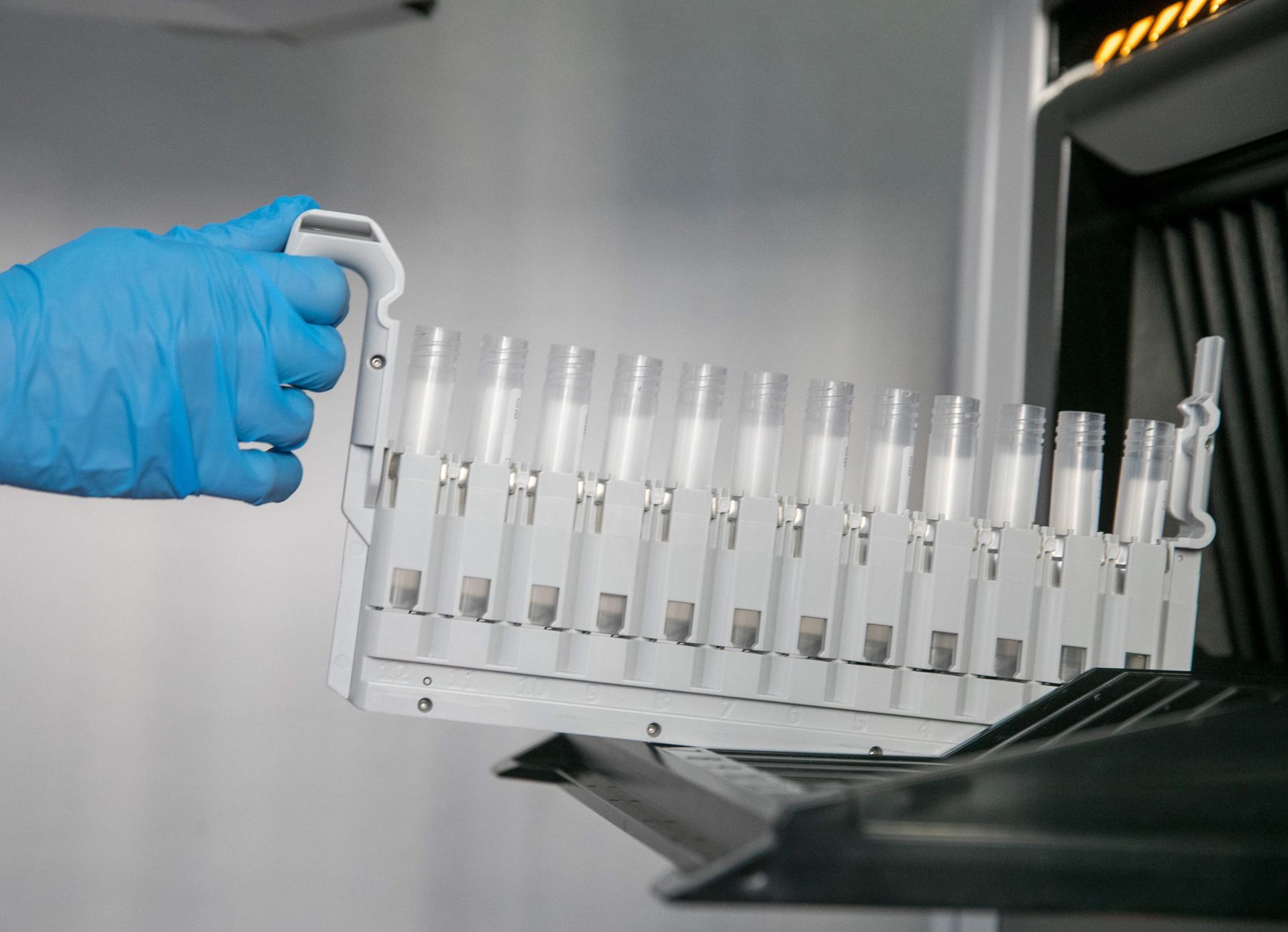 En la imagen de archivo, vista de probetas para los test PCR en el laboratorio de análisis del Hospital Clínico Lozano Blesa de Zaragoza en el año 2020. EFE/Javier Cebollada