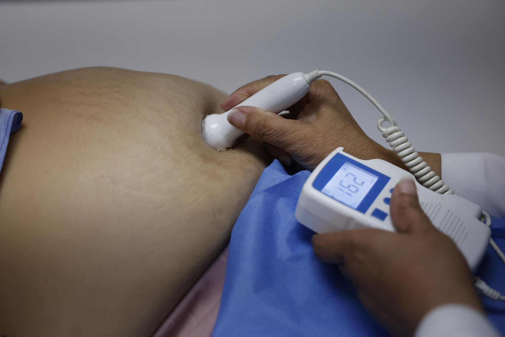 Una mujer embarazada es atendida por personal médico este miércoles, en la Policlínica Santiago Barraza en La Chorrera (Panamá). EFE/ Bienvenido Velasco