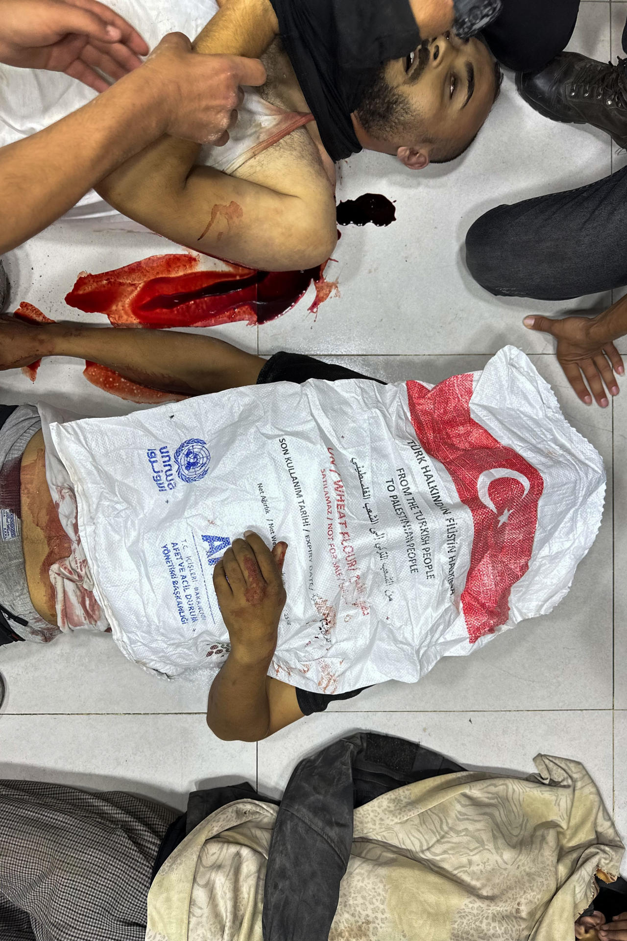 *ACOMPAÑA CRÓNICA* Ciudad de Gaza, 29/06/2025.- Cuerpos de fallecidos en el hospital Al Awda tras la distribución de comida en el centro SDS4. Un único acceso con rejas metálicas lleva a un descampado rodeado de barricadas de arena con neumáticos ardiendo, detrás de las que se apostan tropas israelíes y mercenarios estadounidenses fuertemente armados. En el centro de la explanada, 50 palés con comida: así es uno de los puntos de distribución de la polémica Fundación Humanitaria para Gaza (GHF), que este martes EFE visitó junto a miles de gazatíes en una madrugada sangrienta. EFE/Str
