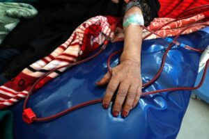 Fotografía de archivo del detalle del brazo de una mujer mientras se somete a un proceso de diálisis. EFE/Yahya Arhab