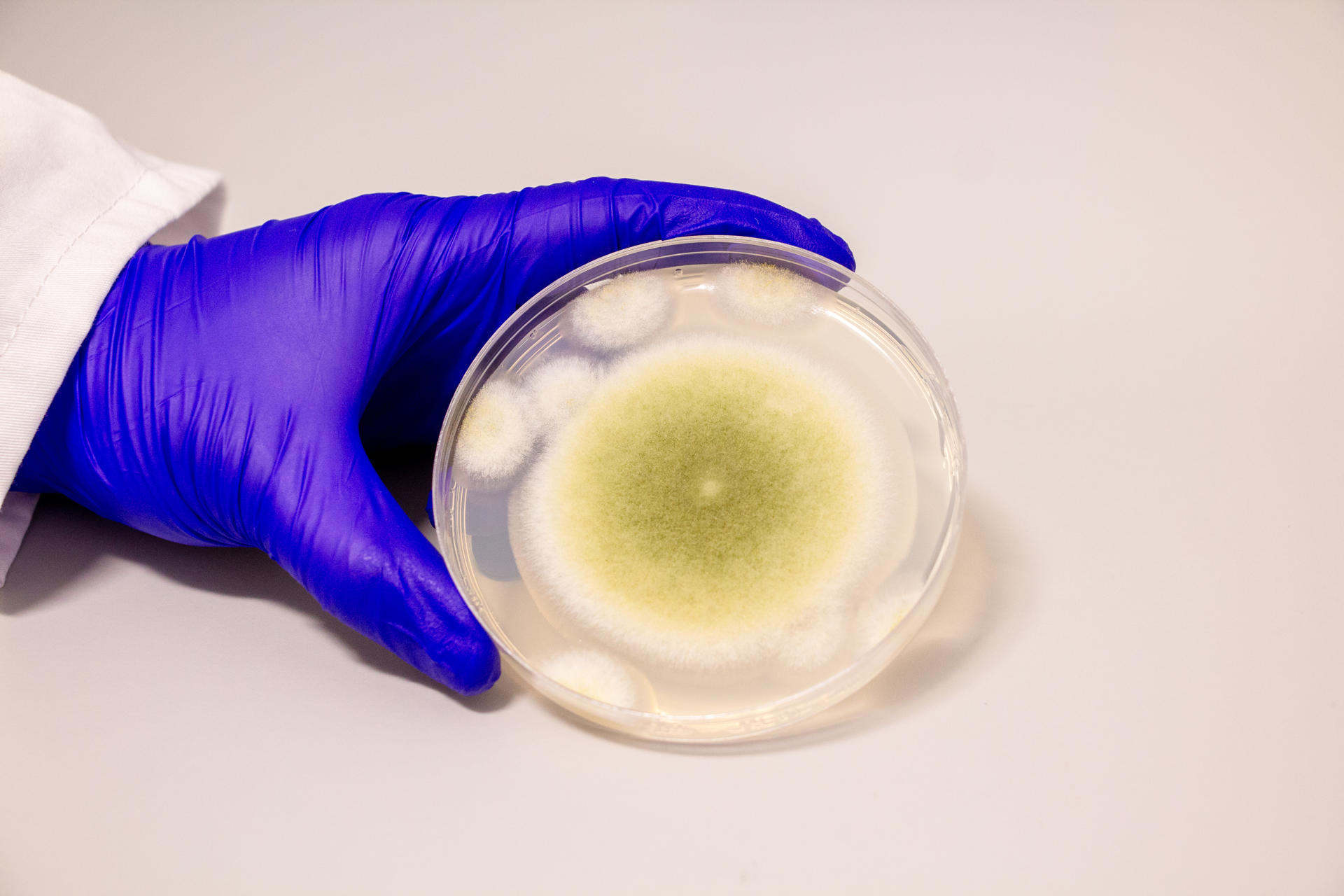 Una muestra de Aspergillus flavus cultivada en el laboratorio Gao. Crédito: Bella Ciervo