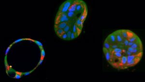 Organoides hepáticos derivados de pacientes y sus mitocondrias (rojo). Crédito: Martijn Koppens