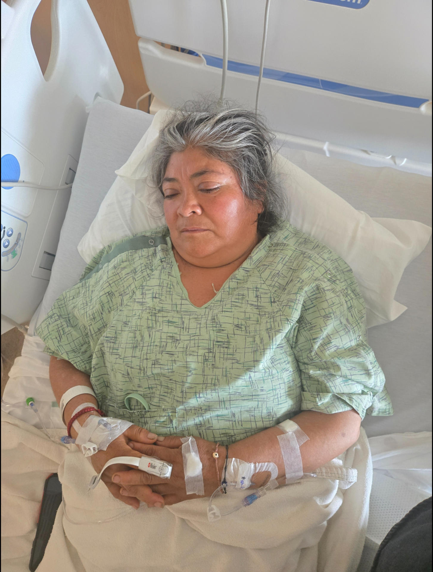 Fotografía cedida por Diana Álvarez donde aparece la inmigrante identificada como Matilde durante su hospitalización, una vendedora de tamales que fue confrontada por agentes de inmigración en el área de Pacoima, en el norte de Los Ángeles (EE.UU.). EFE/Diana Álvarez