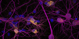 Inmunofluorescencia de neuronas en cultivo; la proteína PKD1 en amarillo. Fotografía facilitada por/ Ana Simón (IIBM-CSIC-UAM). EFE