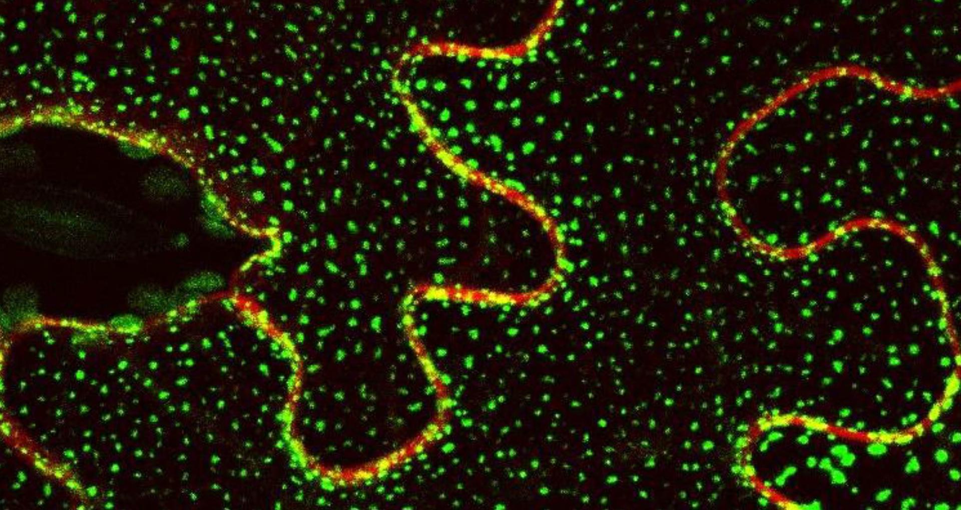 Imagen de microscopía confocal con la localización de la proteína Sinaptotagmina 1 unida a la proteína fluorescente GFP. / IHSM La Mayora