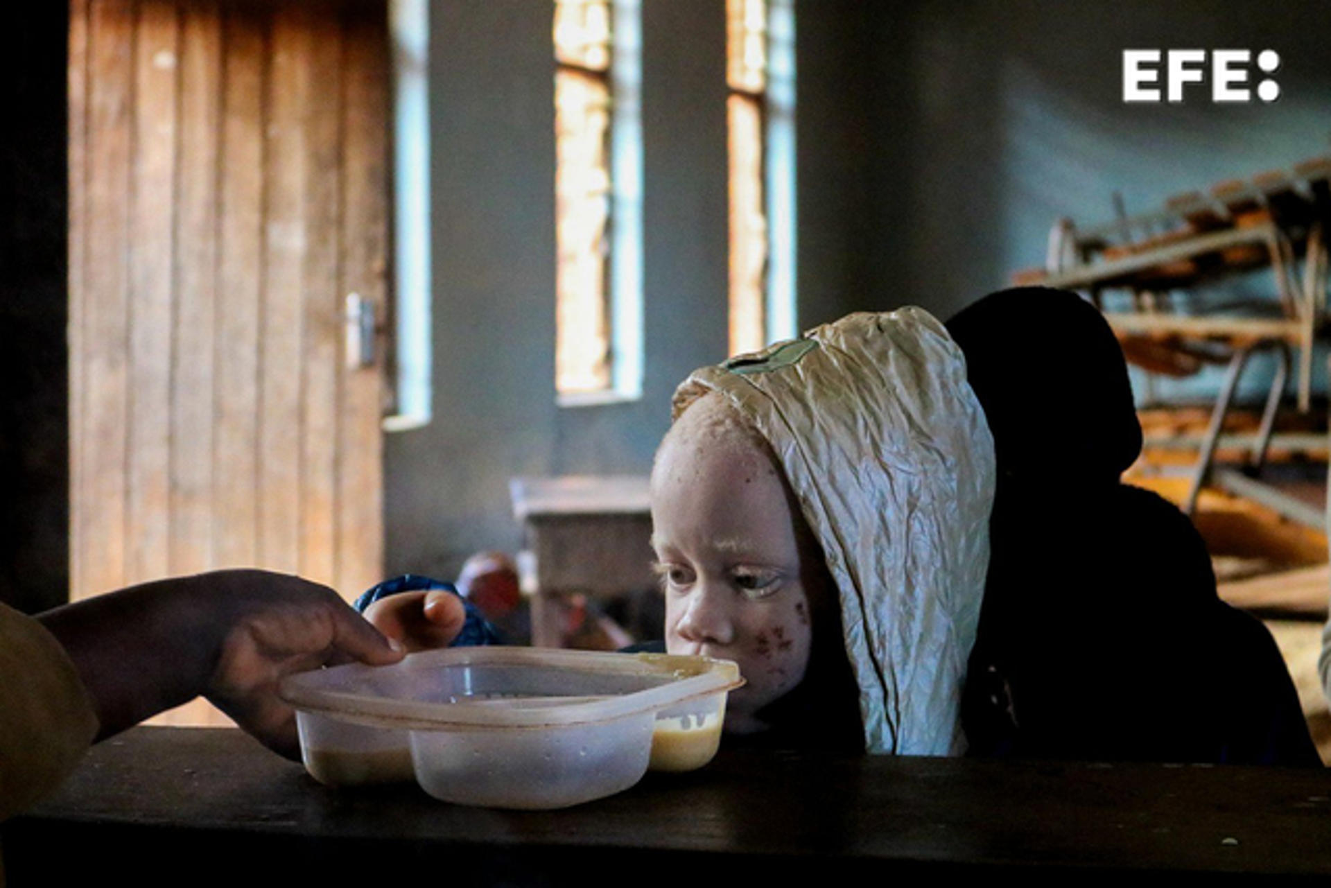 Un estudiante con albinismo recoge su desayuno, unas gachas de maíz enriquecidas proporcionadas por la organización internacional Mary 's Meals. En el corazón del distrito de Kasungu, una región del centro de Malaui golpeada por el cambio climático y el hambre, se alza una escuela única: el Colegio Chilanga para Ciegos, un refugio de aprendizaje y esperanza para niños y niñas con discapacidad visual y albinismo. EFE/Paula García Ajofrin
