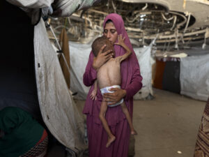 El pequeño gazatí Mohamed Motawaq, de tan solo 18 meses, de cuerpo esquelético pasa los días en Gaza en brazos de su madre, Hidaya, un mujer viuda, de 30 años, sin apenas leche y otros productos básicos por las restricciones que Israel. EFE/ Ahmad Awad