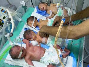 Imagen de archivo de bebes con desnutrición atendidos en un hospital de Gaza.EFE/ Ahmad Awad
