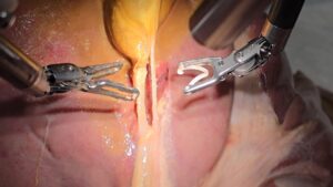 Imagen del robot SRT-H mientras realiza parte de una extirpación de vesícula en un modelo de cerdo 'ex vivo'. Crédito: Ji Woong 'Brian' Kim. Imagen cedida por la Universidad Johns Hopkins.