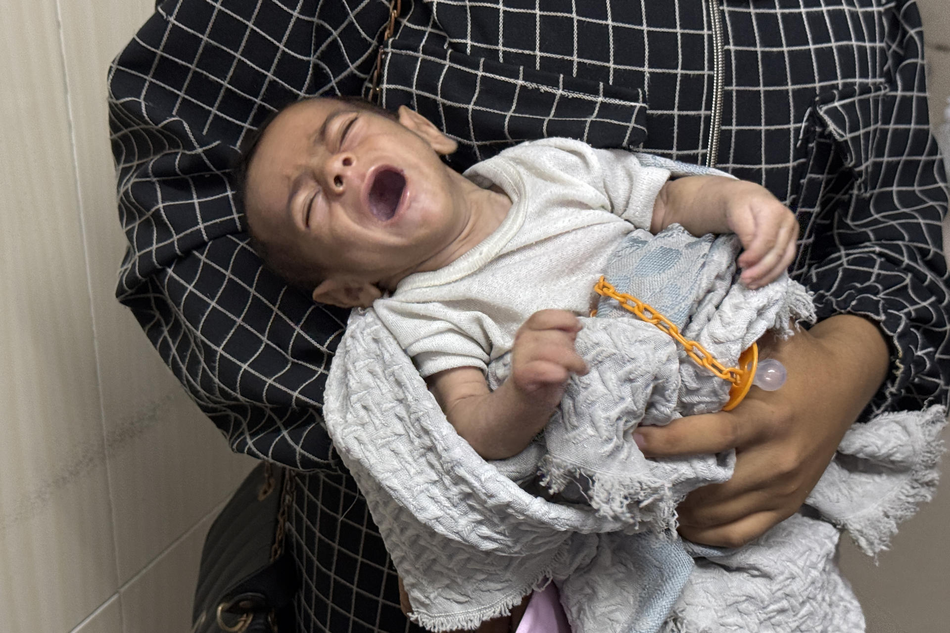 El Hospital de la Sociedad Benéfica de Amigos del Paciente de Ciudad de Gaza está atestado de madres ojerosas y niños cabezudos con cuerpos demasiado pequeños; ojos hundidos, tripas hinchadas y brazos diminutos. Es el único centro pediátrico que trata la desnutrición en el norte de la Franja, donde la hambruna se cobra cada día más vidas, la mayoría de niños. EFE/Ahmad Awad