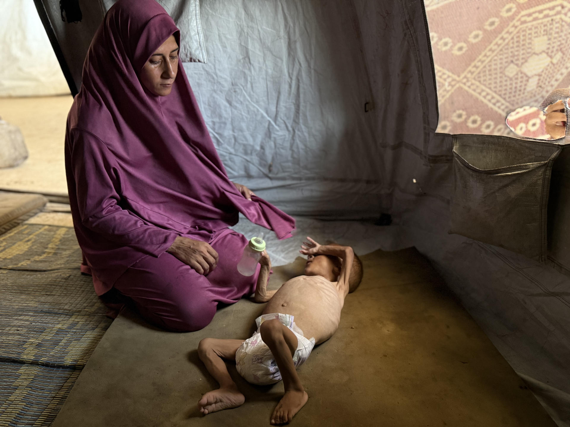 El pequeño gazatí Mohamed Motawaq, de tan solo 18 meses, de cuerpo esquelético pasa los días en Gaza en brazos de su madre, Hidaya, un mujer viuda, de 30 años, sin apenas leche y otros productos básicos por las restricciones que Israel. EFE/ Ahmad Awad
