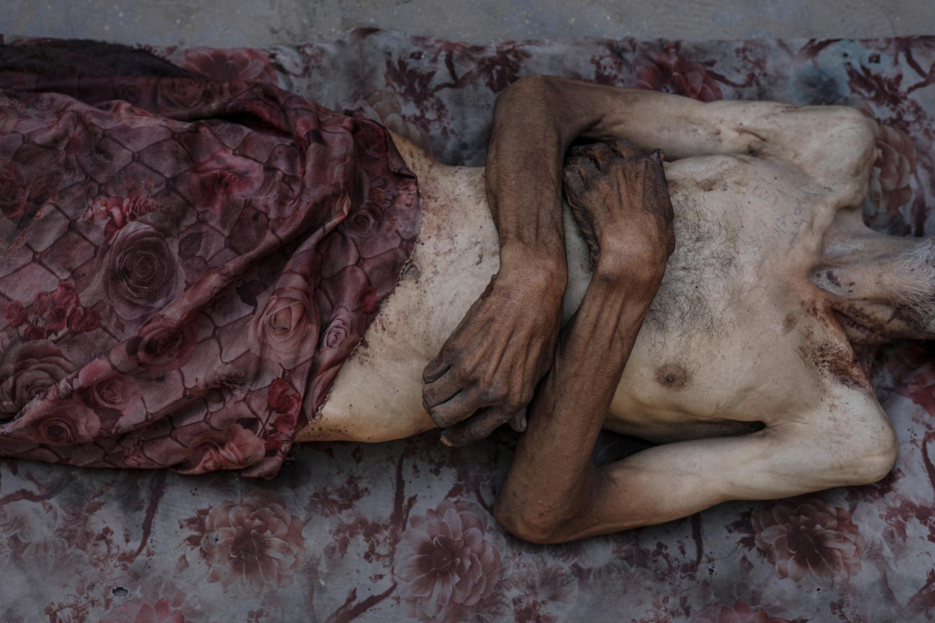 El cuerpo del palestino desplazado internamente Ahmad Al Assi, de 51 años, yace en el Hospital Al Shifa después de ser asesinado a tiros el día anterior en un punto de distribución de alimentos cerca de Zikim en la ciudad de Gaza, el 31 de julio de 2025. EFE/EPA/MOHAMMED SABER -- ATTENTION EDITORS: GRAPHIC CONTENT --