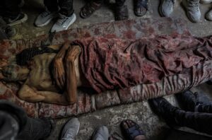 El cuerpo del palestino desplazado internamente Ahmad Al Assi, de 51 años, yace en el Hospital Al Shifa después de ser asesinado a tiros el día anterior en un punto de distribución de alimentos cerca de Zikim en la ciudad de Gaza, el 31 de julio de 2025. EFE/EPA/MOHAMMED SABER -- ATTENTION EDITORS: GRAPHIC CONTENT --