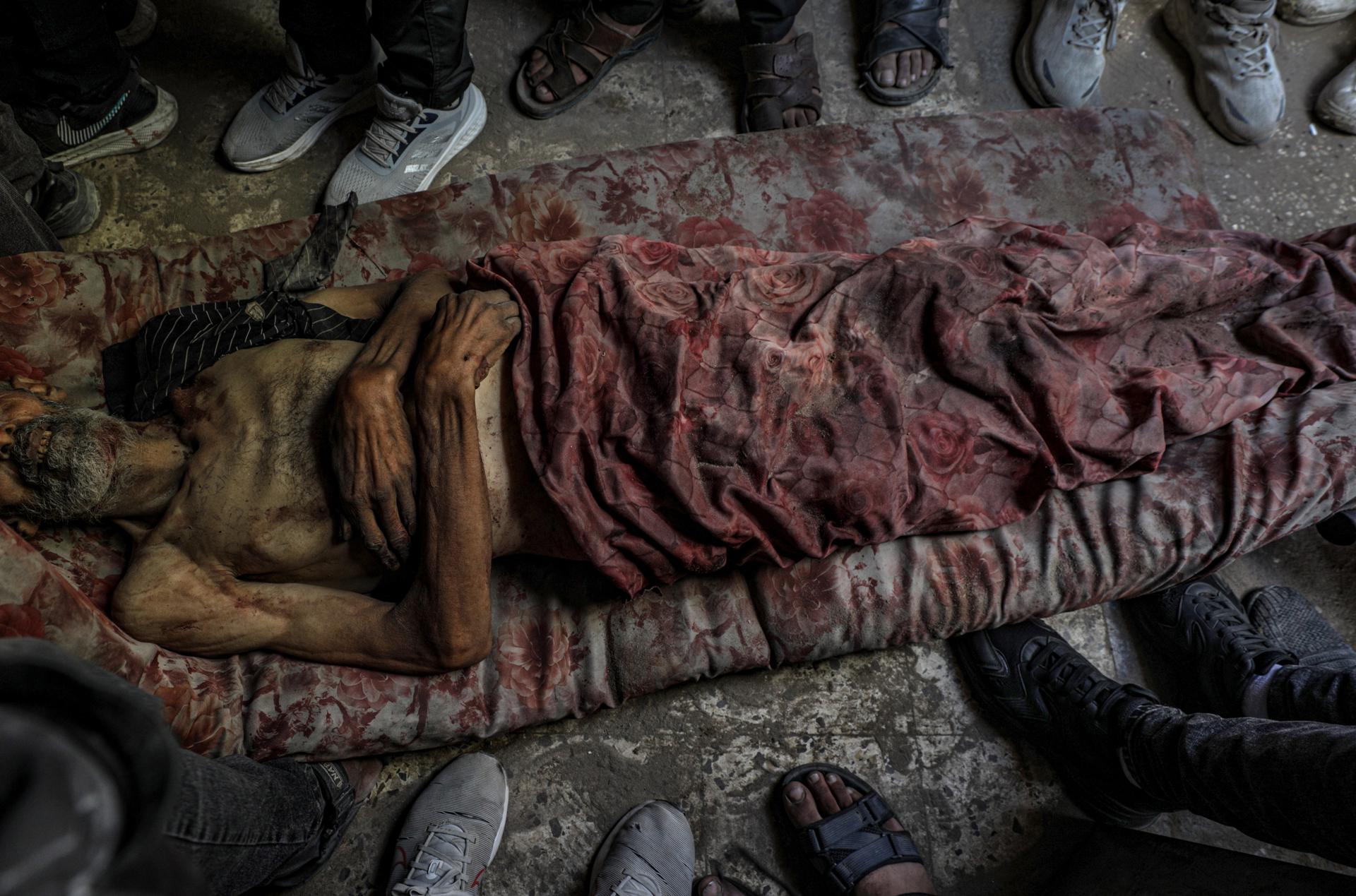 El cuerpo del palestino desplazado internamente Ahmad Al Assi, de 51 años, yace en el Hospital Al Shifa después de ser asesinado a tiros el día anterior en un punto de distribución de alimentos cerca de Zikim en la ciudad de Gaza, el 31 de julio de 2025. EFE/EPA/MOHAMMED SABER -- ATTENTION EDITORS: GRAPHIC CONTENT --