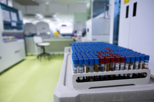 Investigar cómo puede funcionar un órgano según la hora del día para saber el tipo de tratamiento sanitario y a qué hora debe ser aplicado para obtener mejores resultados es el objetivo de la Cronobiología y del grupo de investigación Cronobiolab del Hospital General Universitario de Toledo, único en España en su campo de investigación. EFE/ Ángeles Visdómine