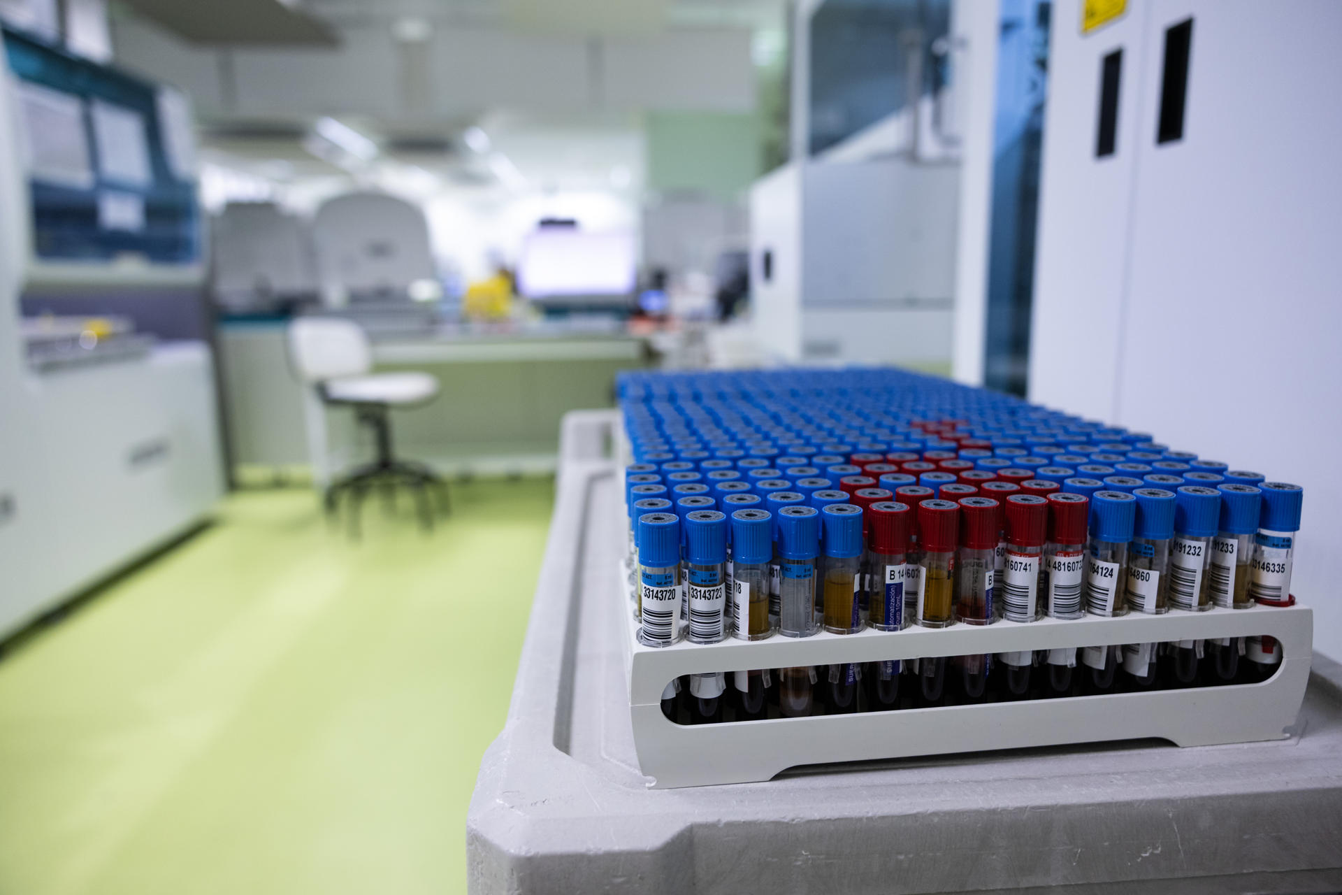 Investigar cómo puede funcionar un órgano según la hora del día para saber el tipo de tratamiento sanitario y a qué hora debe ser aplicado para obtener mejores resultados es el objetivo de la Cronobiología y del grupo de investigación Cronobiolab del Hospital General Universitario de Toledo, único en España en su campo de investigación. EFE/ Ángeles Visdómine