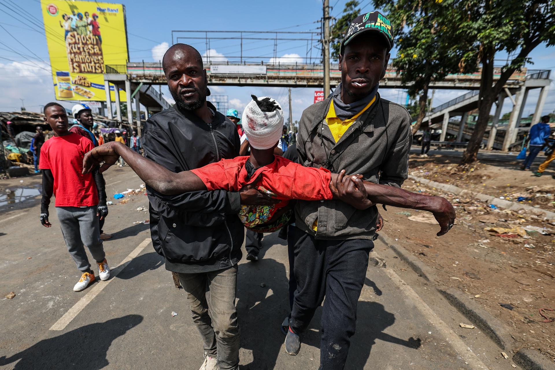 NAIROBI (Kenya), 07/07/2025.- An injured protester is assisted after being shot with a rubber bullet by anti-riot police during anti-government protests on Saba Saba day (or Seven-Seven in Swahili language) in Nairobi, Kenya, 07 July 2025. Nairobi’s Central Business District remained on a lockdown as most business owners hired counter-protesters armed with clubs to protect their business from looters as police used tear gas and rubber bullets to disperse hundreds of protestors in the outskirts of Nairobi during the protest. The Saba Saba Day commemorates protests and government crackdown on a multi-party democracy movement in Kenya in the 1990s. (Protestas, Kenia) EFE/EPA/DANIEL IRUNGU WARNING GRAPHIC CONTENT