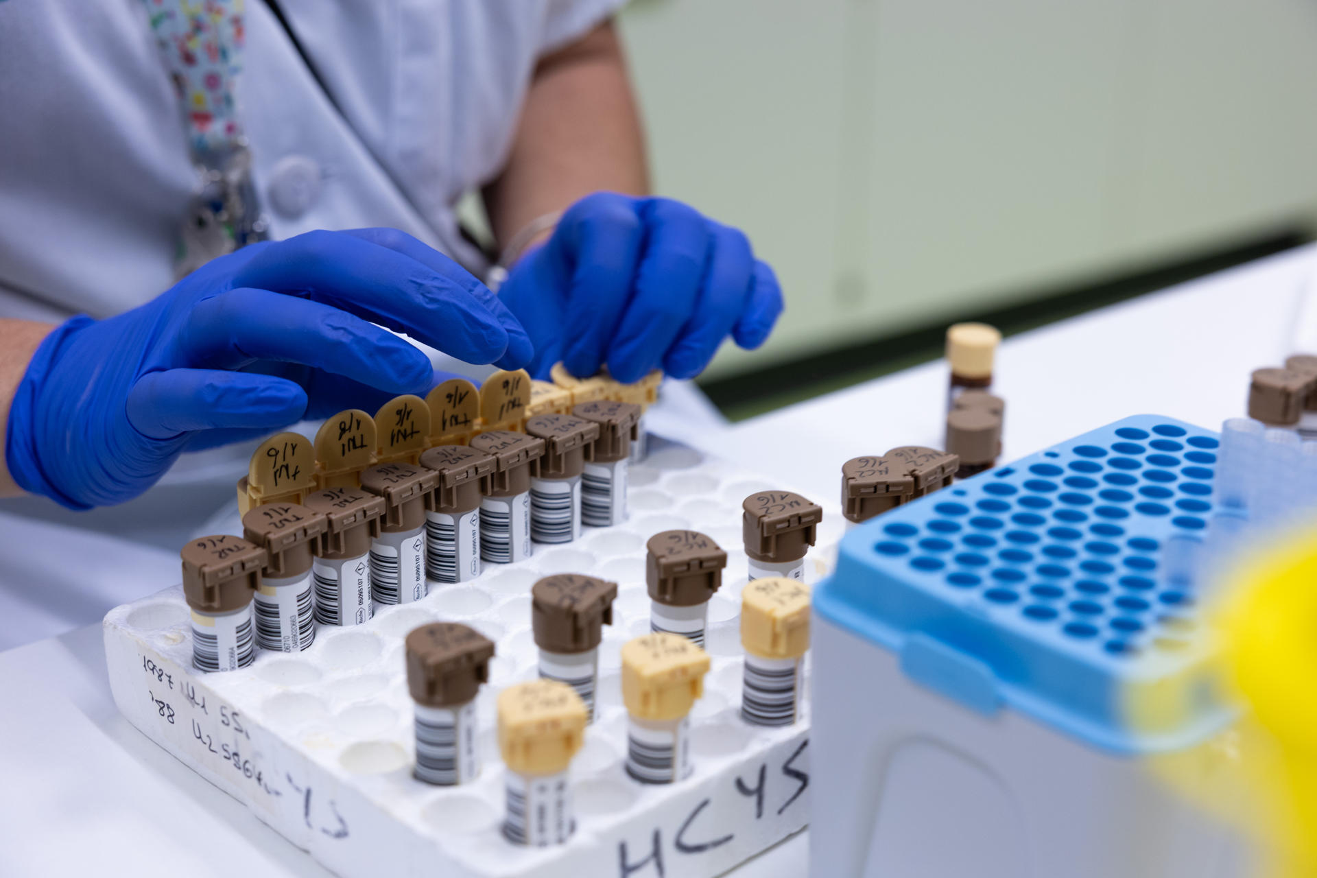 Investigar cómo puede funcionar un órgano según la hora del día para saber el tipo de tratamiento sanitario y a qué hora debe ser aplicado para obtener mejores resultados es el objetivo de la Cronobiología y del grupo de investigación Cronobiolab del Hospital General Universitario de Toledo, único en España en su campo de investigación. EFE/ Ángeles Visdómine