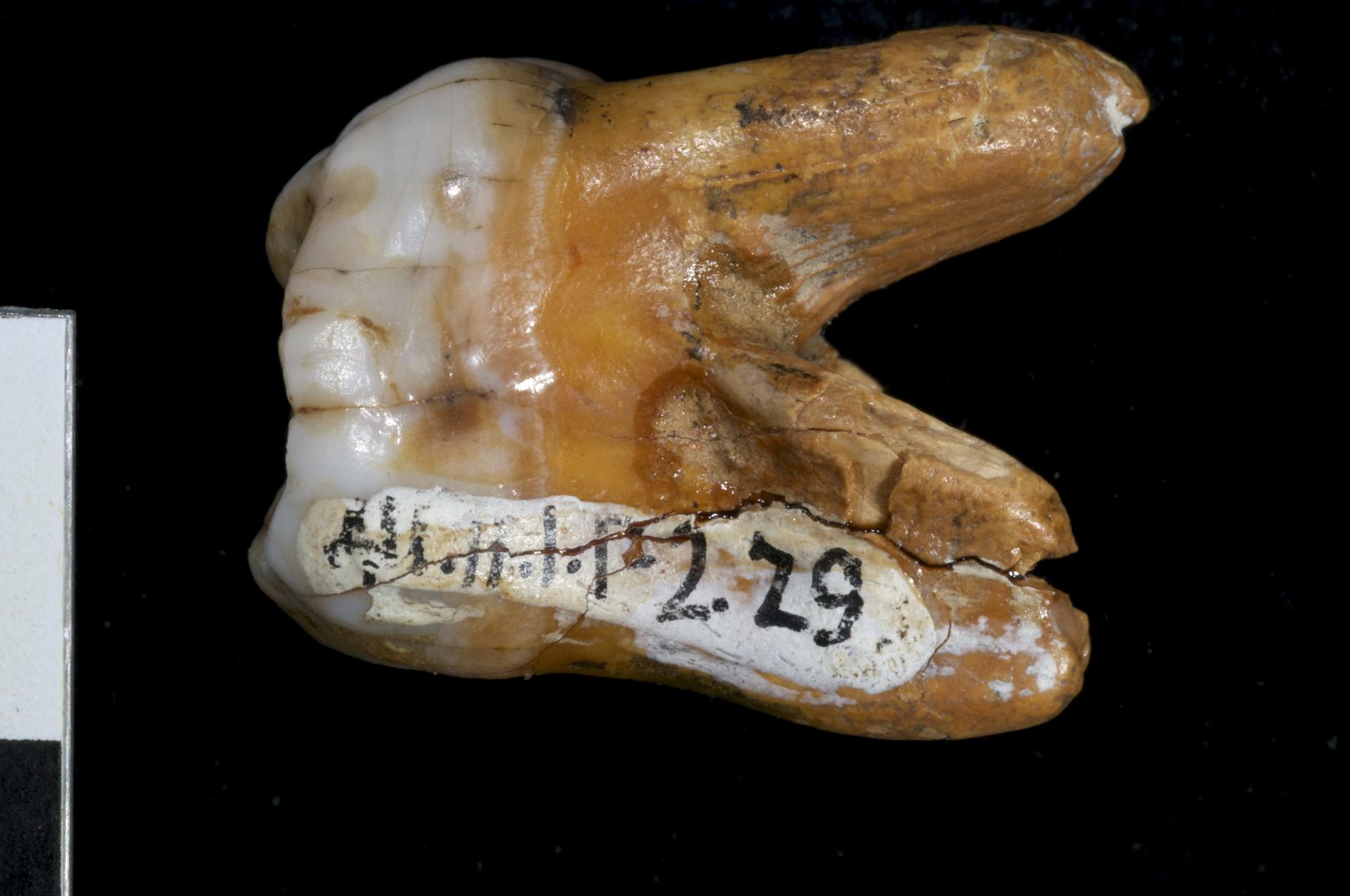 Imagen de archivo facilitada por el Instituto Max Planck de Antropología Evolutiva de la muela de 'denisovano' hallada junto al homínido que vivió hace al menos 30.000 años en Siberia (Rusia), que arqueólogos rusos descubrieron en la cueva Denisova, en el sur de Siberia, en 2008. EFE/Dr. Bence Viola ***SÓLO USO EDITORIAL***