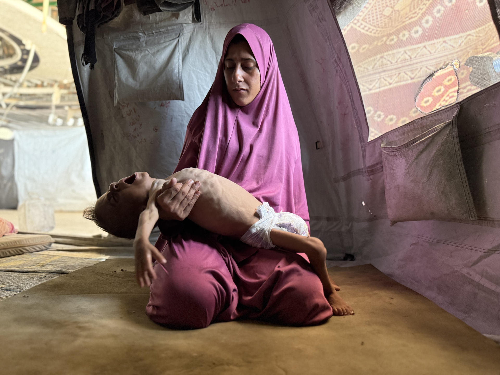 Imagen de 27 de julio de 2025 del pequeño gazatí Mohamed Motawaq, de tan solo 18 meses, de cuerpo esquelético en brazos de su madre, Hidaya al Mutauaq, un mujer viuda, de 30 años, sin apenas leche y otros productos básicos por las restricciones de Israel. EFE/Ahmad Awad
