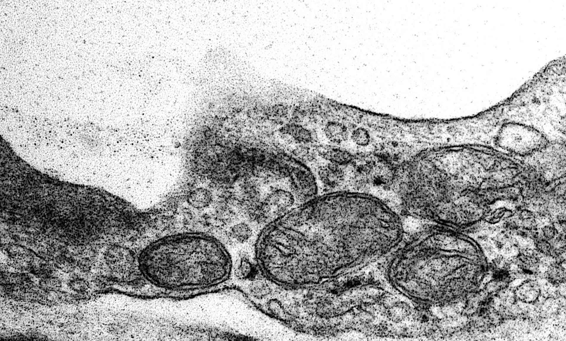 El estudio revela que mejorar la función de las mitocondrias, las fábricas de energía de las células, puede proteger al cerebro y aliviar déficits de conducta en un modelo del síndrome genético 22q11.2. La imagen de microscopía electrónica muestra mitocondrias en células endoteliales del cerebro de animales con dicha afección. Crédito: imagen cortesía del laboratorio de Jorge Iván Álvarez, de la Universidad de Pensilvania.