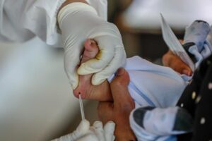 Imagen de archivo de la prueba de atrofia muscular espinal (AME) en un bebé. EFE/EPA/MARK R. CRISTINO