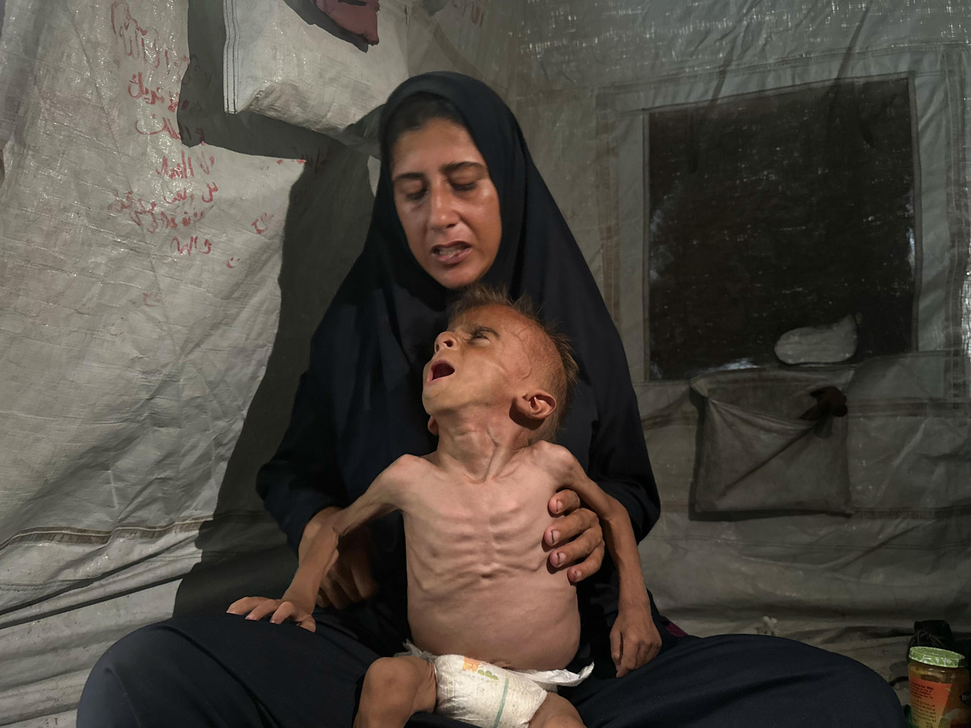 La crisis por desnutrición en Gaza ganó visibilidad con imágenes como las del pequeño Mohamed Motawaq, de tripa hinchada y brazos esqueléticos. Israel aseguró que la suya era la foto de "un niño enfermo" utilizada por la prensa para difundir una falsa hambruna en Gaza, algo que la madre del niño no sólo denuncia, sino que asegura ha empeorado su condición. Con Mohamed en brazos, Hidaya (31 años), recibe por segunda vez a EFE en su tienda de campaña y confirma que su hijo tiene una debilidad muscular, pero la conversación la impregna el miedo de que sea el hambre lo que le mate.-EFE/ Ahmad Awad