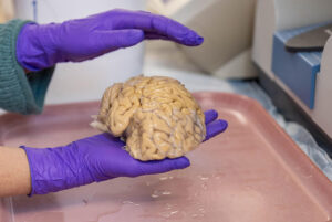 Cerebro de un  'superanciano' donado en la Universidad Northwestern de Chicago, Illinois. Shane Collins, Universidad Northwestern