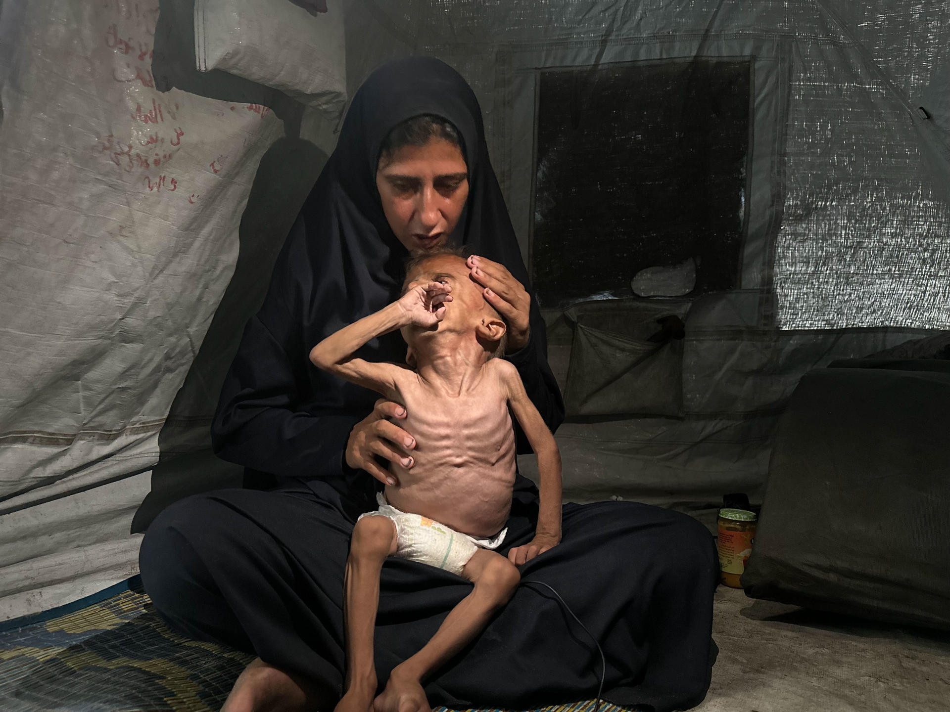 La crisis por desnutrición en Gaza ganó visibilidad con imágenes como las del pequeño Mohamed Motawaq, de tripa hinchada y brazos esqueléticos. Israel aseguró que la suya era la foto de "un niño enfermo" utilizada por la prensa para difundir una falsa hambruna en Gaza, algo que la madre del niño no sólo denuncia, sino que asegura ha empeorado su condición. Con Mohamed en brazos, Hidaya (31 años), recibe por segunda vez a EFE en su tienda de campaña y confirma que su hijo tiene una debilidad muscular, pero la conversación la impregna el miedo de que sea el hambre lo que le mate.-EFE/ Ahmad Awad