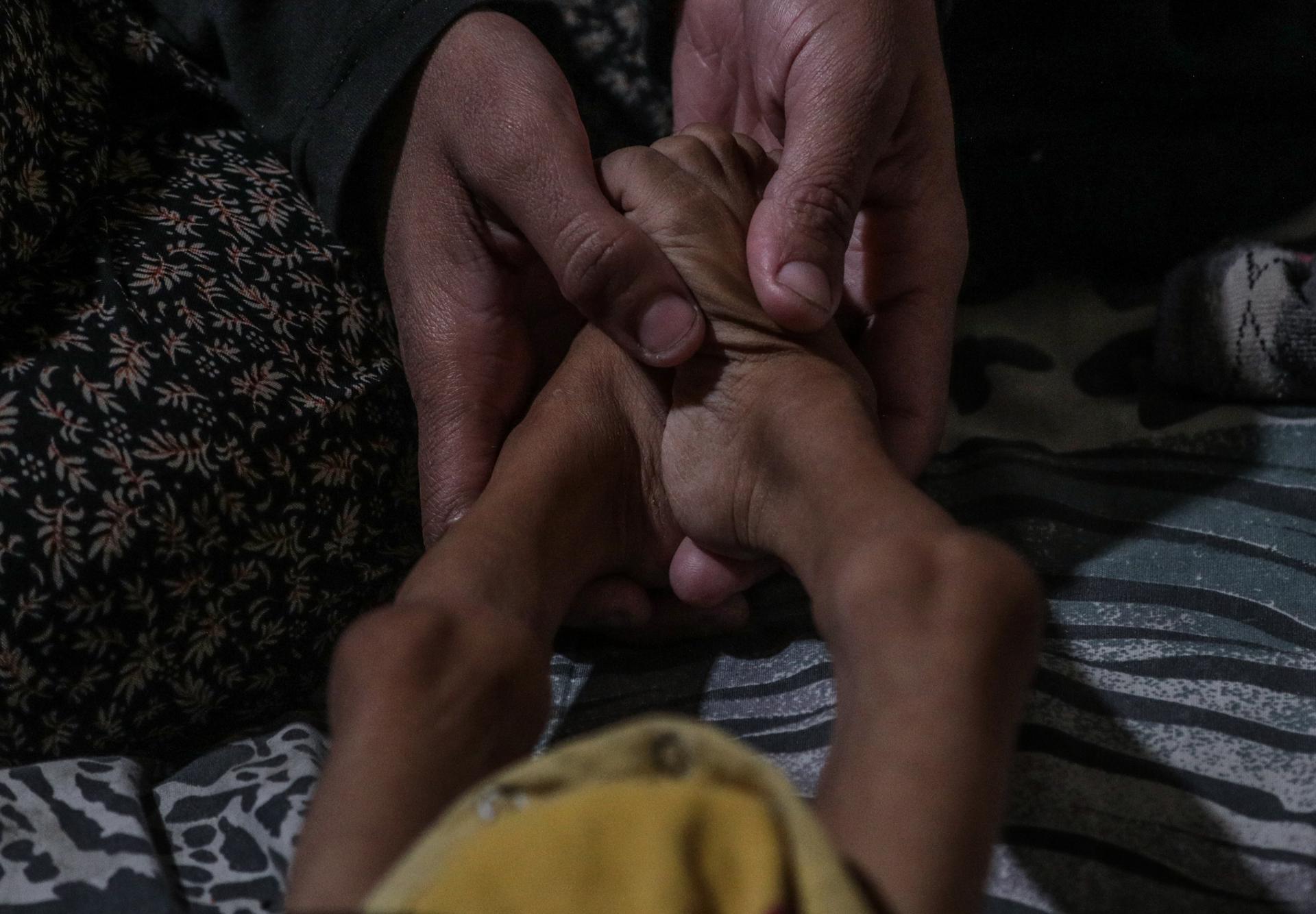 Foto de archivo del 25 de diciembre de 2024 en la que una madre palestina desplazada internamente cuida a su hija de cinco años que sufre de desnutrición, Misk Bilal Al Madhoun, dentro de su refugio en Deir al-Balah, en la Franja de Gaza central. EFE/EPA/MOHAMMED SABER