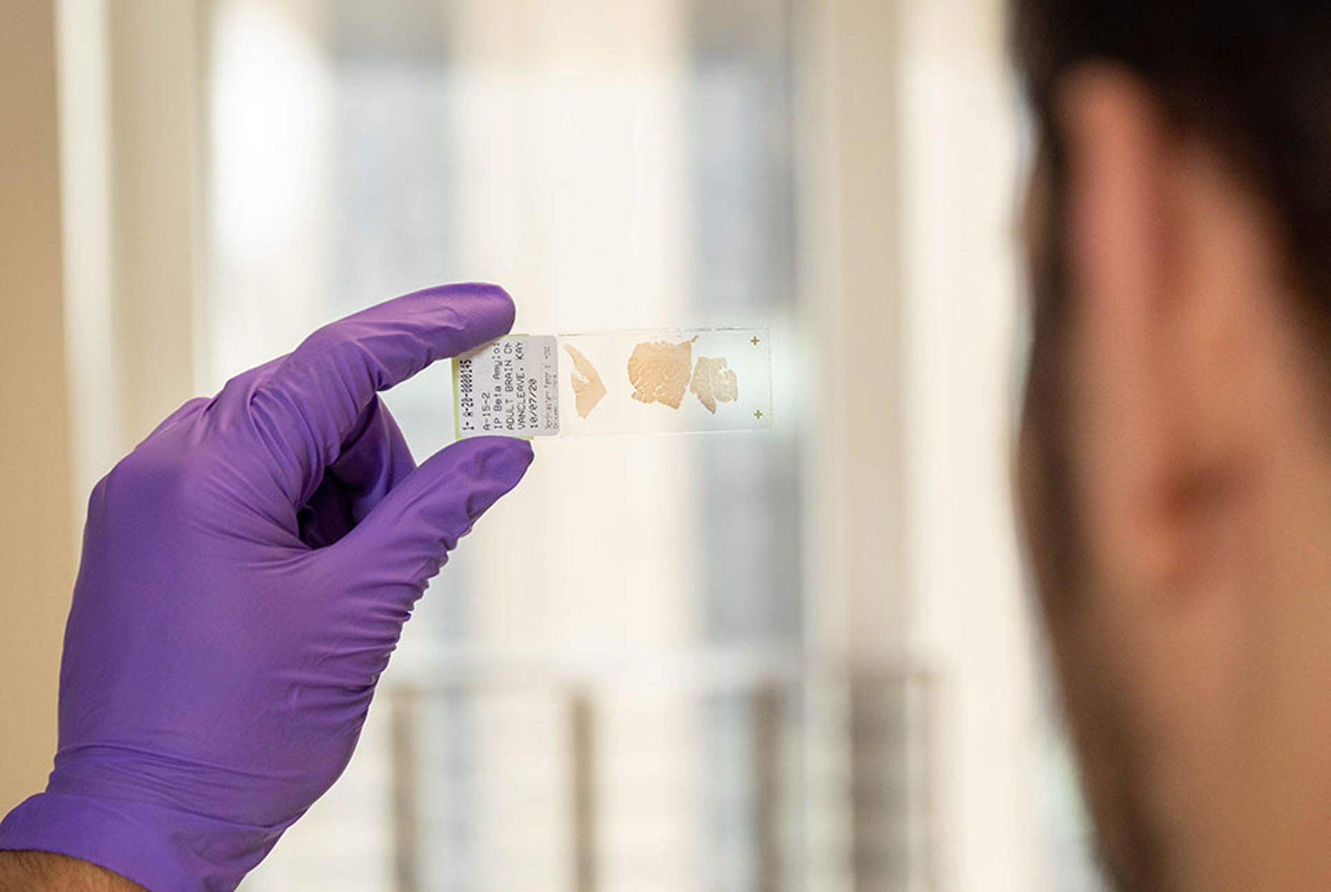 Un miembro del laboratorio de la Universidad Northwestern examina un portaobjetos de vidrio que contiene una lámina finísima del cerebro de un 'superanciano'. Shane Collins, Universidad Northwestern