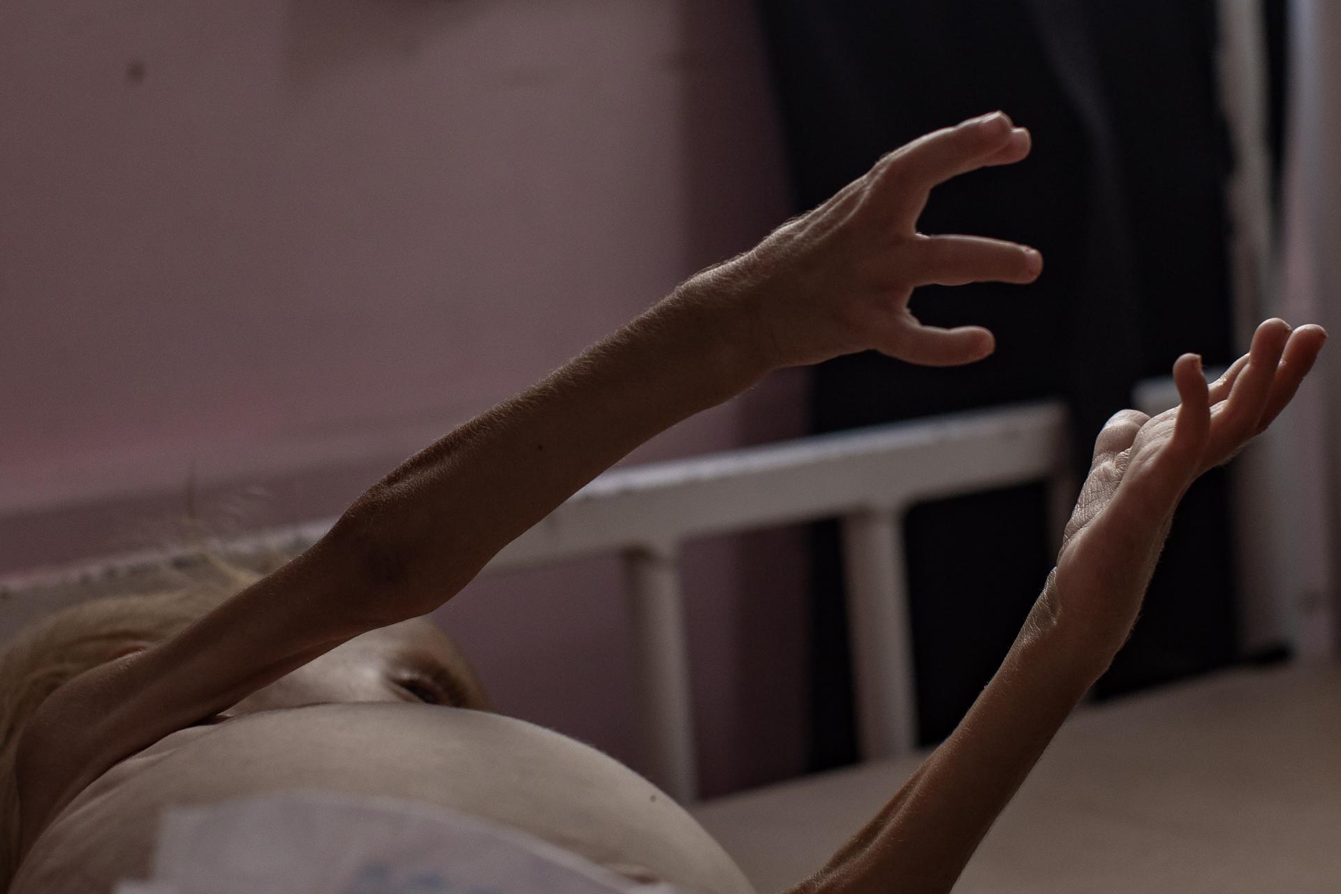 Sham Qudeih, un niño palestino de dos años, yace desnutrido en una cama en el Hospital Nasser, en Jan Yunis, en el sur de la Franja de Gaza, el 10 de agosto de 2025. EFE/HAITHAM IMAD